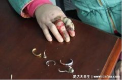 为什么千万不要戴戒指打保龄球，戒指会将