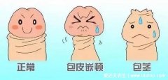 小儿包茎症状图片，有包皮嵌顿或者全包型