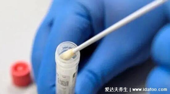 新冠无症状感染者具有什么特点,核酸阳性但无症状(3个特点)