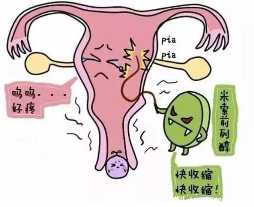药流10个人有9个流不干净，不是说不能成功(最佳时间要注意)