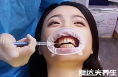 一个牙医的良心忠告，一定不能错过的四大