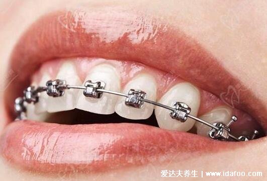 医院牙科收费价目表,2022年看牙注意牙医的良心忠告(不花冤枉钱)