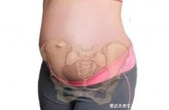 孕妇耻骨位置图，大腿跟内侧和小肚子交界