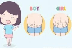 孕期征兆暗示你生男孩!快看看你的妊娠线