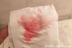 怎么分辨例假推迟和怀孕，教你看内裤一招