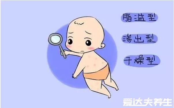 真实新生儿湿疹图片,小儿湿疹有三大类型注意区分