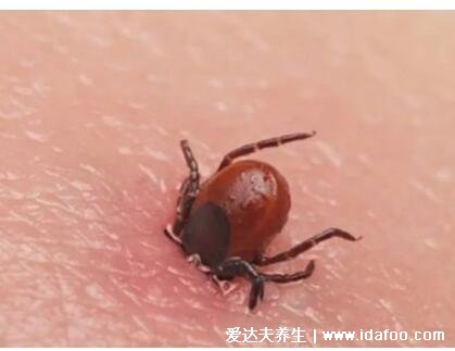 真实恙虫病图片症状,咬人后伤口会由皮疹到焦痂(体温高热)
