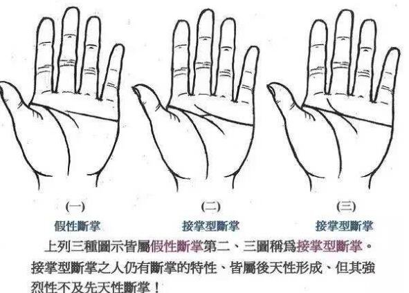 真正的断掌纹图片,3种断掌有不同的运势(假性断掌)