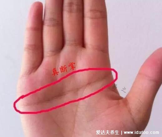 真正的断掌纹图片,3种断掌有不同的运势(假性断掌)