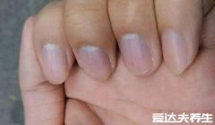 指甲竖纹多是癌症的可能性不大，多为正常