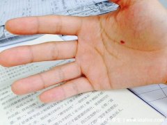 朱砂痣据说是上辈子爱你的人，朱砂痣的寓