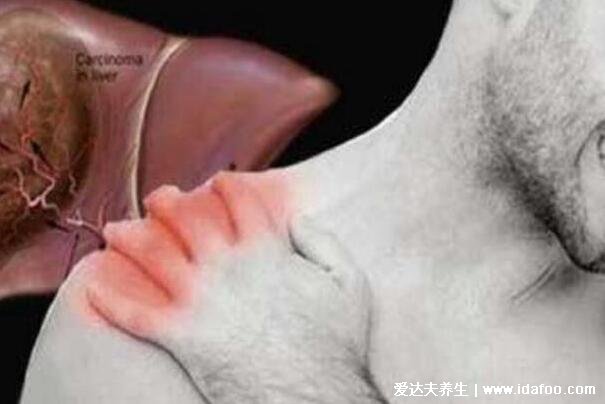 癌症前期的18种预兆和图片,常见的乳腺癌/胃癌/肝癌症状合集