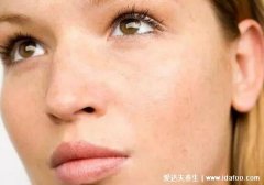 超雌综合症 特别漂亮并不一定但智力低下