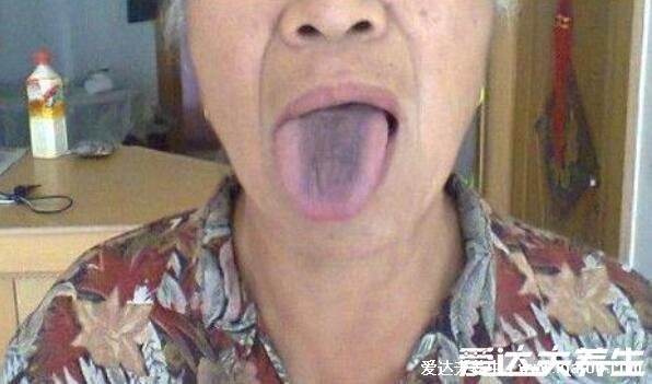 饭后有三种迹象暗示胃癌,饭后上腹痛/饱腹不适(胃癌早期症状)