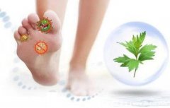 脚气怎么治疗能除根,可用枯矾/黄柏/五倍子