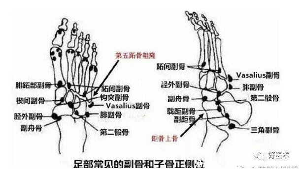 脚的结构图和名称,由骨骼/肌肉/血管/神经构成的重要器官
