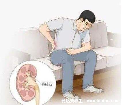 肾结石会引起身体哪个部位疼痛图片,腹痛/腰痛(肾疼腰疼区别图)