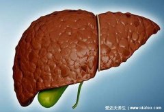 脂肪肝最怕三种食物,长期坚持吃西红柿/西