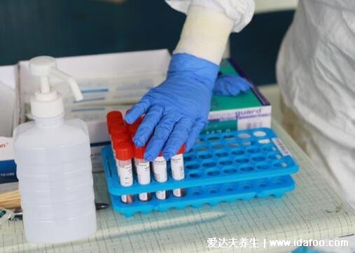 自费核酸检测一次多少钱,公立医疗机构收费几十/民营不超160元