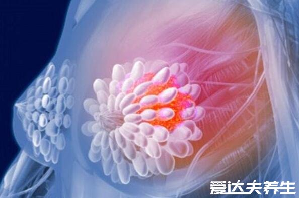 不影响寿命的十大癌症,甲状腺癌/膀胱癌/前列腺癌对寿命都没影响