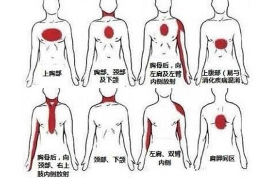 后背疼痛要警惕的三种病,警惕颈椎病/风湿病/心脏问题