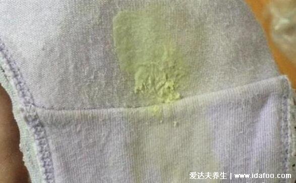 女性感染hpv是什么病毒图片,警惕低危型尖锐湿疣/高危型宫颈癌