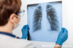 体检尽量别做肺部ct，原则上次数越少越好（