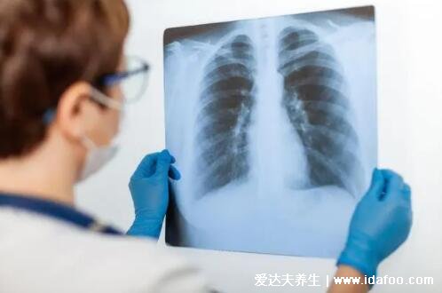 体检尽量别做肺部ct,原则上次数越少越好(3类人不能做)