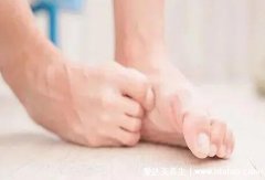 为什么中医说有脚气是好事,可能考虑身体