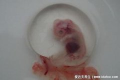 流产掉下来的完整孕囊图片,有肉感的粉白