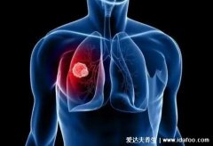 肺结节吃什么食物散结节最快,注意5点肺结