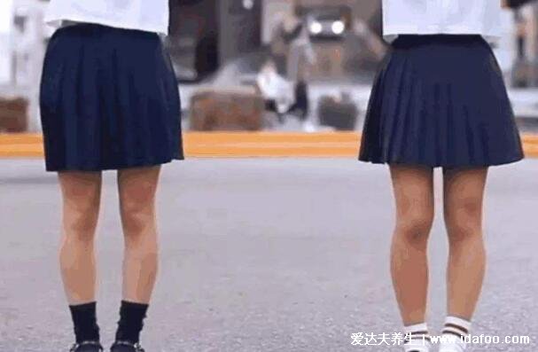 罗圈腿图片是什么样子,o型腿怎么矫正动作图
