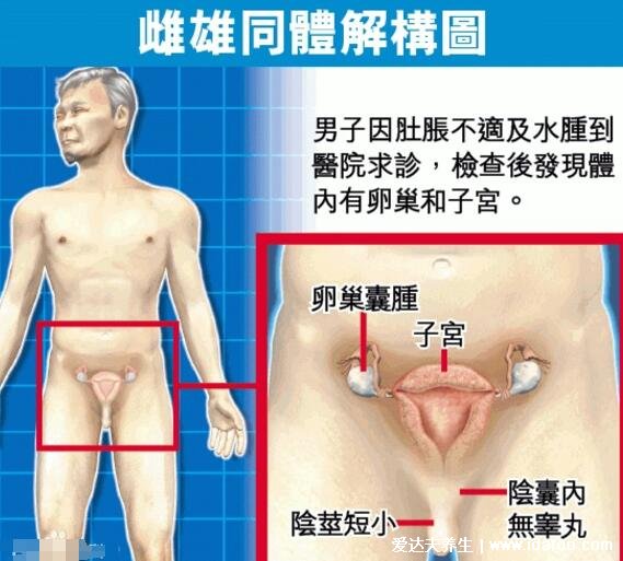 真实双性人图片，同时拥有男女生殖器官(雌雄同体)