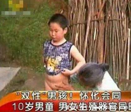 真实双性人图片，同时拥有男女生殖器官(雌雄同体)