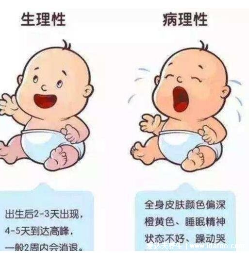 婴儿30天黄疸值对照表,看胆红素超221病理性黄疸(24小时内出现)