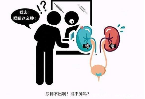 膀胱癌的早期症状图,警惕粉红色的尿液是血尿(5大前兆)