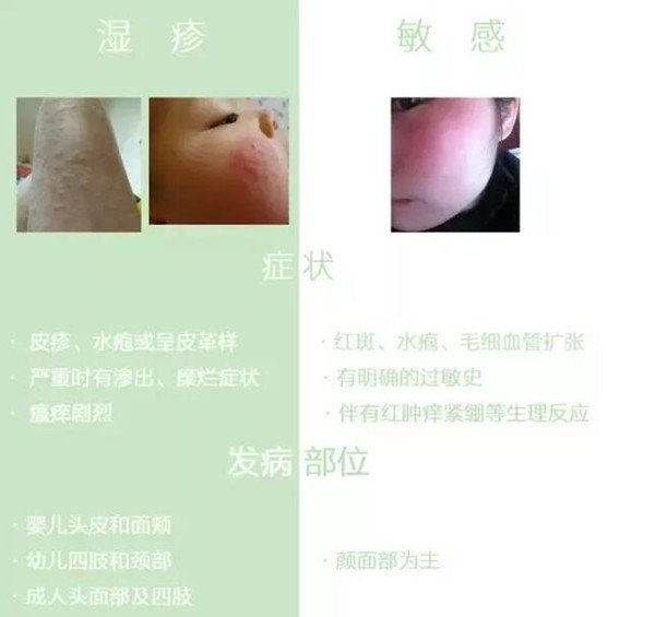 新生儿脸上有小红点图解,中毒性红斑是新生儿常见疾病(3种可能)