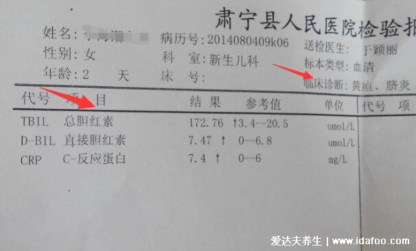 婴儿30天黄疸值对照表,足月新生儿正常值低于12.9(早产儿15)