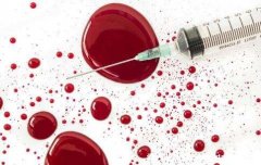 怎么判断一个人艾滋病，留意是否具有高危