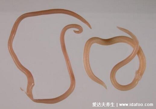 拉出来的蛔虫图片及感染症状,长得像蚯蚓的寄生线虫(活动引发腹痛)