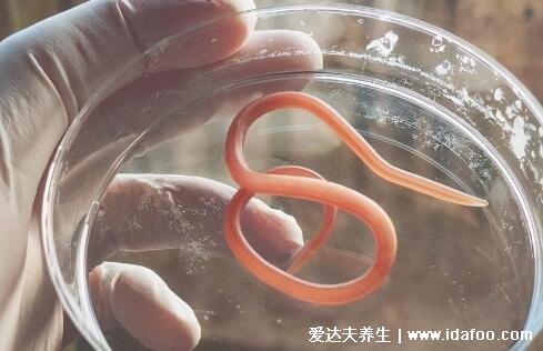 拉出来的蛔虫图片及感染症状,长得像蚯蚓的寄生线虫(活动引发腹痛)