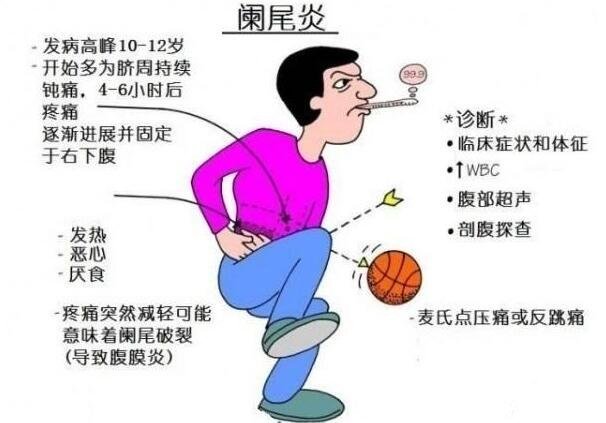 阑尾在左边还是右边哪个位置,右下腹看阑尾炎的疼痛位置图片