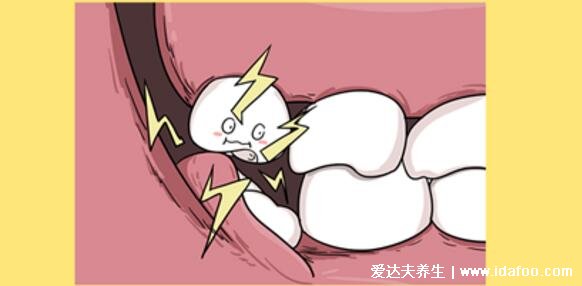 智齿一定要拔吗，4种情况不痛也必须拔(附不需要拔的智齿图片)
