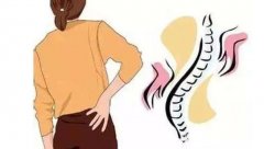 腰椎间盘突出十大禁忌，房事上轻度者建议