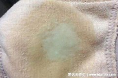 滴虫性阴炎的主要症状图片,黄绿色泡沫状