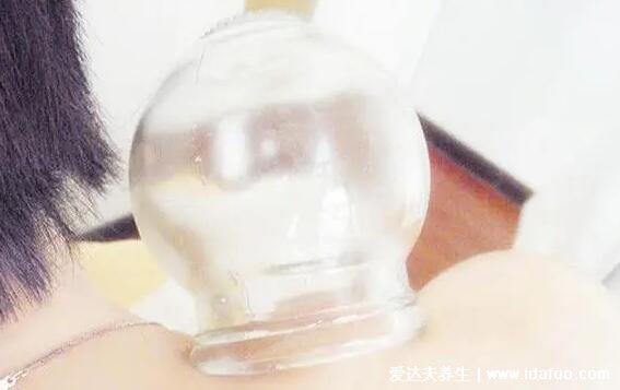 拔罐后多长时间可以洗澡,6小时后小心风邪发炎等(有皮损时间要延长)