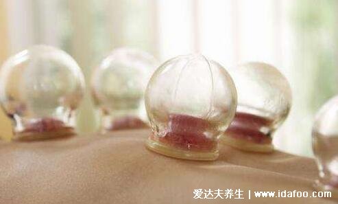 拔罐后多长时间可以洗澡,6小时后小心风邪发炎等(有皮损时间要延长)