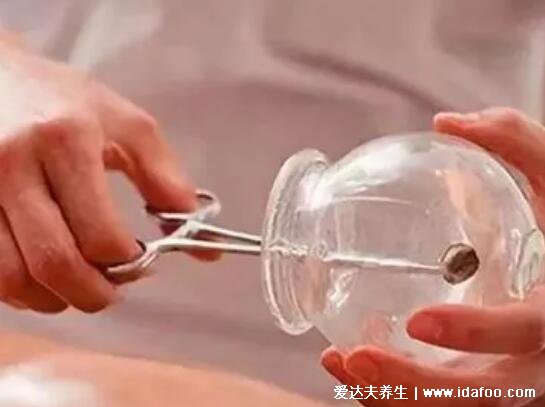 拔罐后多长时间可以洗澡,6小时后小心风邪发炎等(有皮损时间要延长)