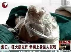 世界上十大必死病图片，狂犬病病死率接近