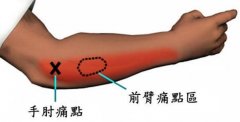 网球肘在哪个位置图片，网球肘的按摩手法